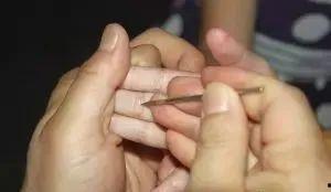 扎四缝视频,传统养生法在现代生活中的应用与益处